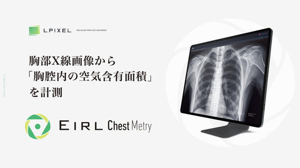 EIRL Chest Metry EIRL Chest Metry