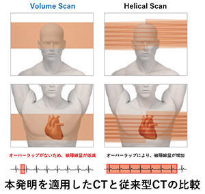 本発明を適用したCTと従来型CTの比較