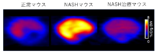 概要図 肝臓における[11C]グルタミン PET 画像