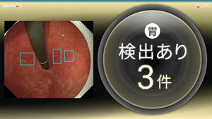 検出ありの場合