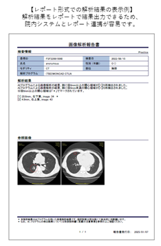 胸部CT画像解析AIエンジンDoctorNET MONCAD CTLN