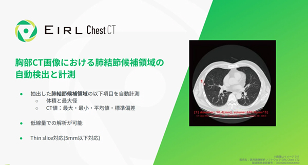 EIRLChest CT EIRLChest CT