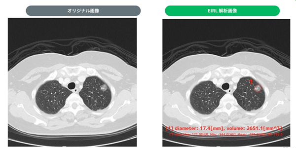 <2> 17.4mm 部分充実型 <2> 17.4mm 部分充実型