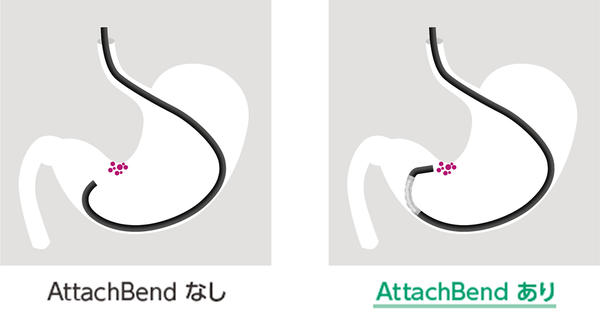 「AttachBend」を装着することで操作性が向上するイメージ 「AttachBend」を装着することで操作性が向上するイメージ