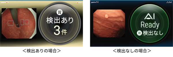 内視鏡画像診断支援ソフトウェアgastroAI 内視鏡画像診断支援ソフトウェアgastroAI