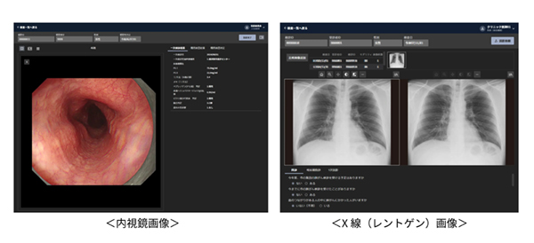 gastroBASE screening X gastroBASE screening X