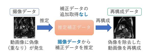 本発明による撮像の流れ