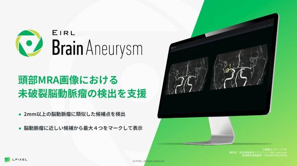 頭部MRA画像から脳動脈瘤候補点を検出するEIRL Brain Aneurysm,偽陽性の低減を実現した新モデルを発売 頭部MRA画像から脳動脈瘤候補点を検出するEIRL Brain Aneurysm,偽陽性の低減を実現した新モデルを発売