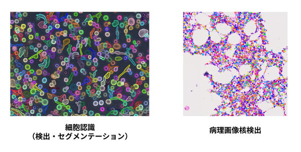 解析画像例