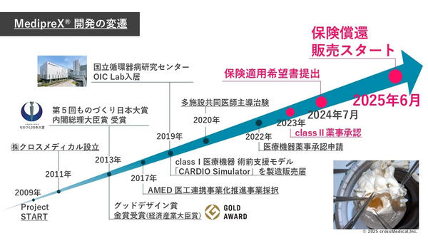 開発の変遷 開発の変遷