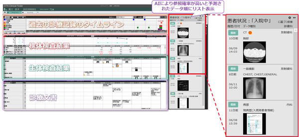 「参照支援サジェストAI機能」のユーザーインターフェース（左）。検査画像や文書など，医療従事者が参照する可能性の高いデータ（右）をリスト表示する。