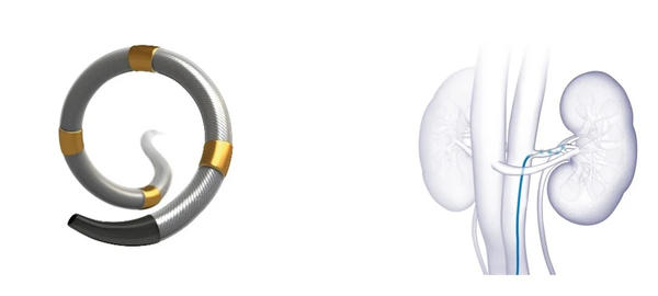 Symplicity Spyral 腎デナベーションシステム 医療機器承認番号:30700BZX00207000 Symplicity Spyral 腎デナベーションシステム 医療機器承認番号:30700BZX00207000