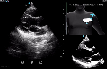 ※Cardiac Guidance/ Interpretationの実際の画面 ※Cardiac Guidance/ Interpretationの実際の画面