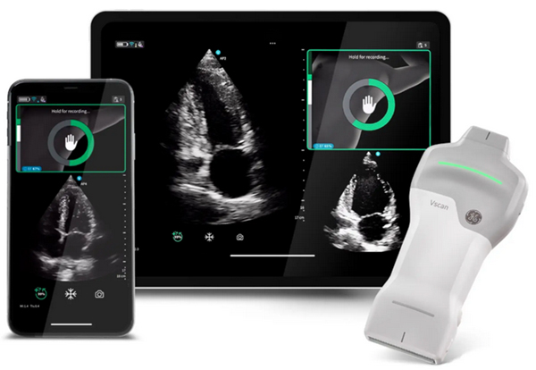 ※Cardiac Guidanceによる心エコー検査のリアルタイムガイド表示機能。Quality Meterで画像クオリティを確認,画面上部にはイラストとともに「時計回りにゆっくりと回転」などリアルタイムに様々なガイダンスが表示される。 ※Cardiac Guidanceによる心エコー検査のリアルタイムガイド表示機能。Quality Meterで画像クオリティを確認,画面上部にはイラストとともに「時計回りにゆっくりと回転」などリアルタイムに様々なガイダンスが表示される。