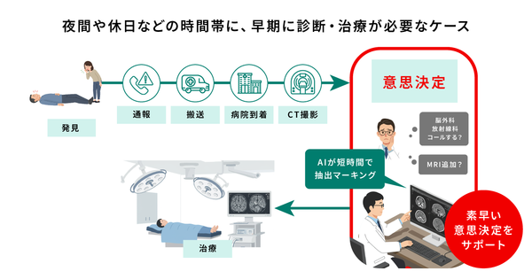 医療現場での「頭部CT画像解析AIエンジン DoctorNET Heuron CTS」の活用イメージ 医療現場での「頭部CT画像解析AIエンジン DoctorNET Heuron CTS」の活用イメージ