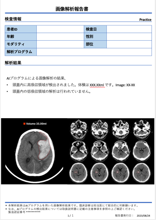 DoctorNET Heuron CTSのレポートフォーマット(高吸収領域の検出時) DoctorNET Heuron CTSのレポートフォーマット(高吸収領域の検出時)