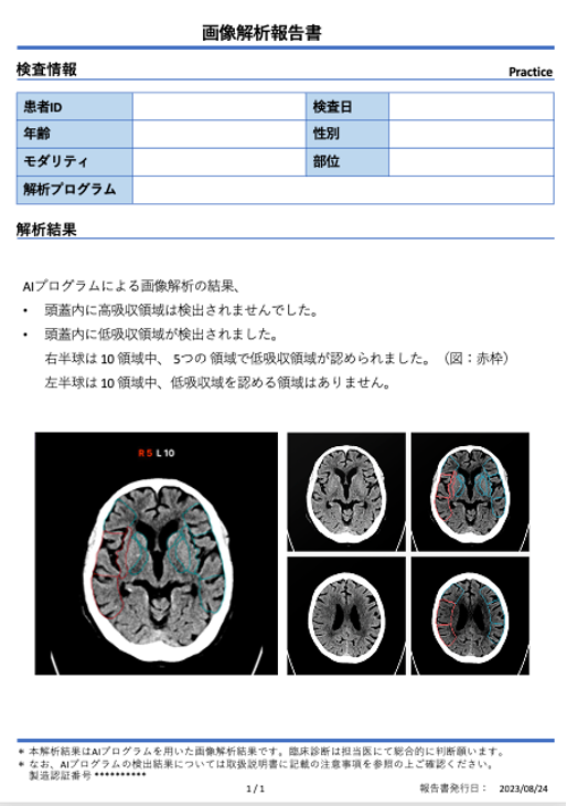 DoctorNET Heuron CTSのレポートフォーマット(低吸収領域の検出時) DoctorNET Heuron CTSのレポートフォーマット(低吸収領域の検出時)