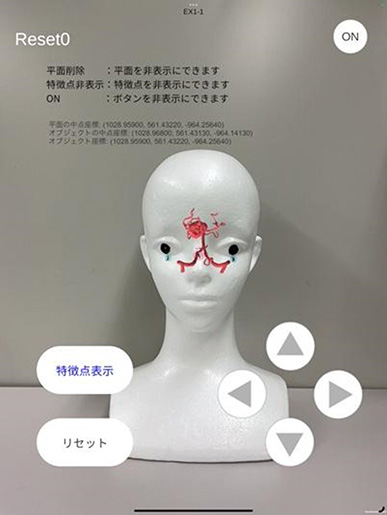 張ジョ 准教授(情報デザイン学科)が考案した頭部手術における患部提示アプリケーション 張ジョ 准教授(情報デザイン学科)が考案した頭部手術における患部提示アプリケーション
