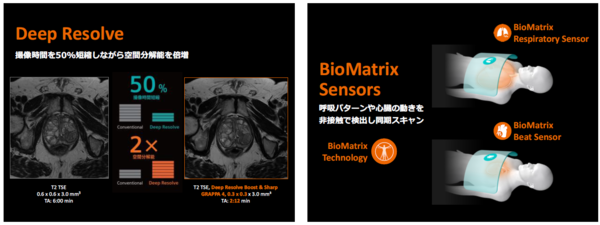 AIによる画像再構成技術や各種センシング技術により，被検者の動きや操作者の熟練度に左右されない高精度な検査を提供