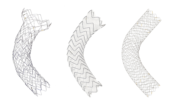 スプライダー胃十二指腸ステント，ジャバラ大腸ステント，Bactrian大腸ステント