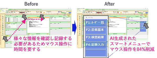電子カルテの画面上にタイル形式で表示された次の操作候補イメージ