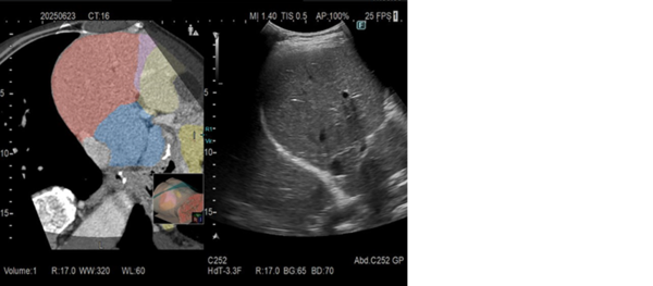 造影CTデータの輝度解析により領域分類された参照画像をバーチャル像上へ重畳表示