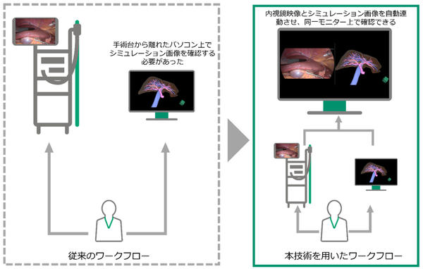 手術中に，手術台から離れたパソコン上で事前に作成したシミュレーション画像をみる従来のワークフローと，内視鏡映像とシミュレーション画像を自動連動させて同一モニター上で確認する本技術を用いたワークフローを比較した様子