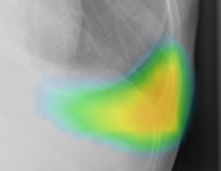 ヒートマップ表示