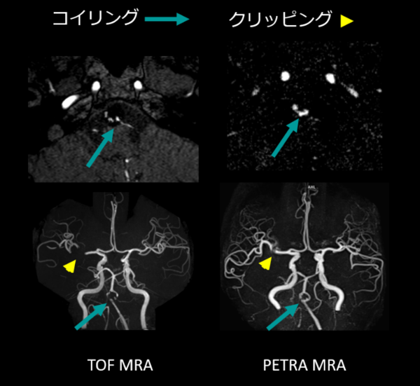 PETRA MRA