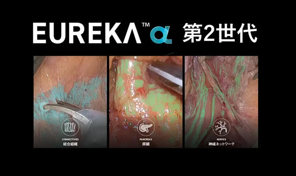 「Eureka α」は，様々な構造物をリアルタイムに視覚化し，術者の認識を支援する
