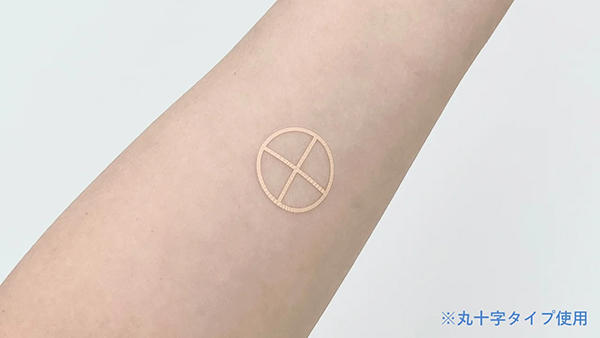 放射線治療用ガイドマーカーシール