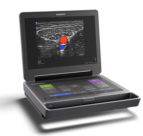 Sonosite MT
