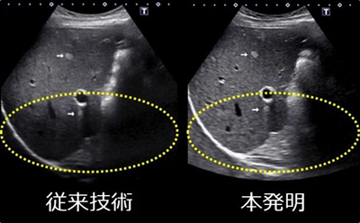 比較画像