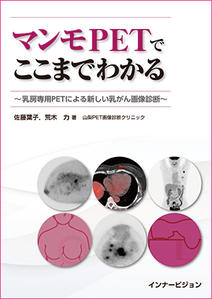 マンモPETでここまでわかる 〜乳房専用PETによる新しい乳がん画像診断〜