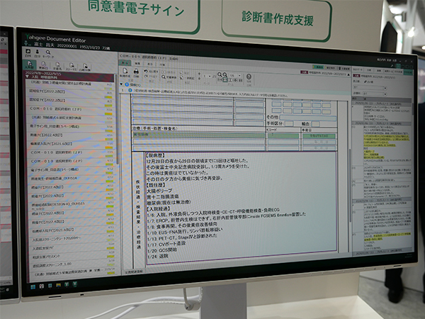 Yahgeeの画面に統合されて利用できるサマリ作成支援AI