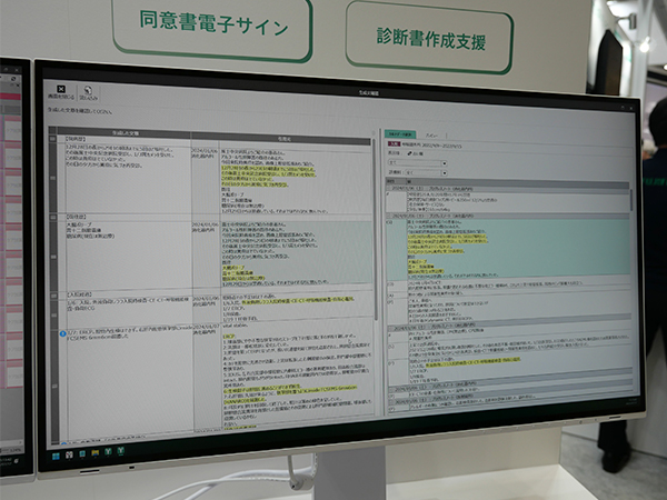 ハルシネーション確認画面では根拠となった記事を対照しながら確認が可能