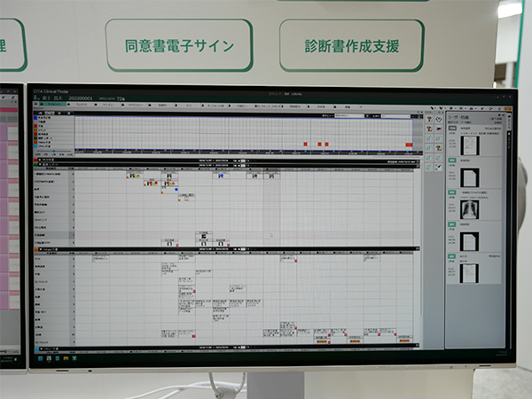 参照支援サジェストAIでは右側のウインドウに次の参照データをリコメンド