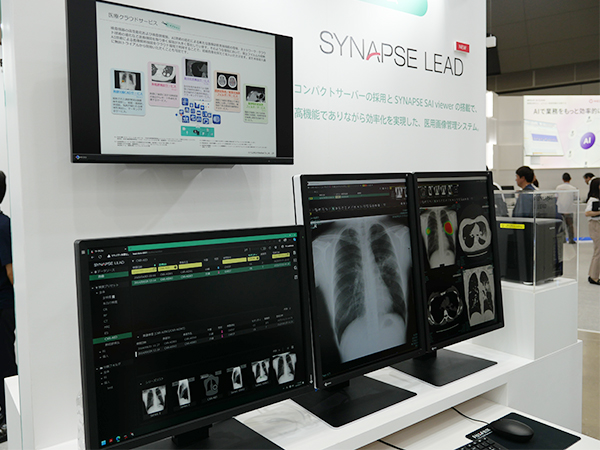 クリニックや中小病院向け新しいPACS「SYNAPSE LEAD」
