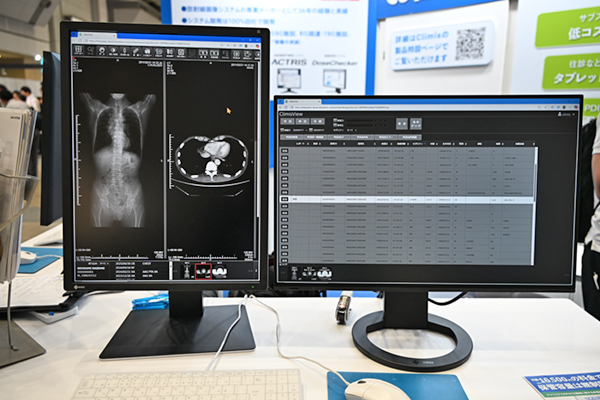 常に最新の機能が使える「Climis」のDICOM画像ビューワ 常に最新の機能が使える「Climis」のDICOM画像ビューワ