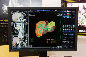 “新・肝臓解析”ブラッシュアップして精度を上げ，RIなどの機能検査との融合を可能とするなど，機能強化が図られた。