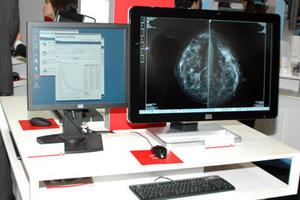 Coronis Fusion 10MP