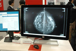 Coronis Fusion 10MP