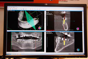 歯科用DICOMビューワ「DentistVision Professional」