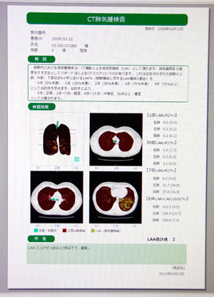 「LungVision」の結果レポート