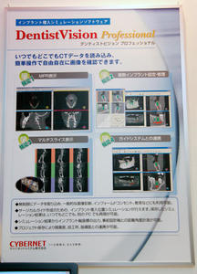 「DentistVision Professional」の紹介