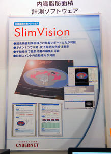 「SlimVision」の紹介
