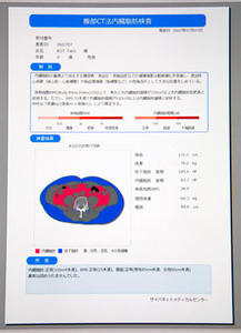 「SlimVision」の結果レポート