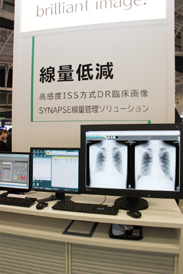 ISS方式を採用し低線量でのDR画像と線量管理ソリューション（WIP）を紹介