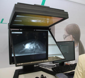 高精細画像の立体視によって診断をサポートする「リアル3Dマンモグラフィ」