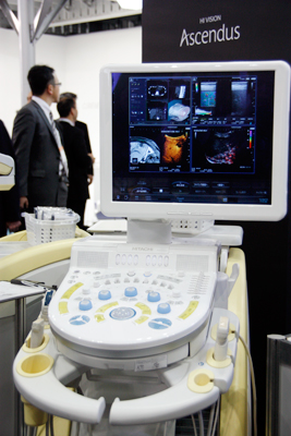 超音波診断装置「Ascendus」：RVS（左上と左下）とReal-time Tissue Elastography（右上）の表示